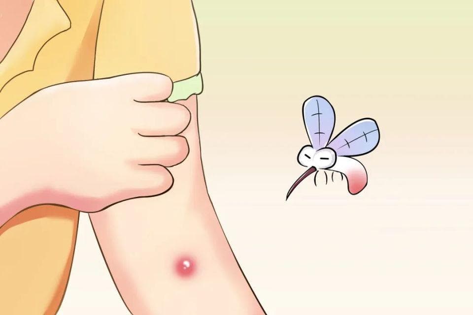 蚊叮虫咬后的“红疙瘩”，这样处理好得快