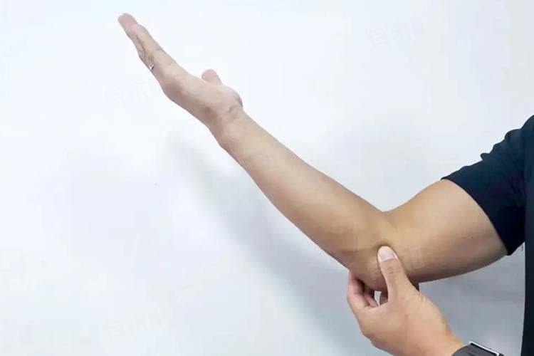 手肘关节痛怎么办