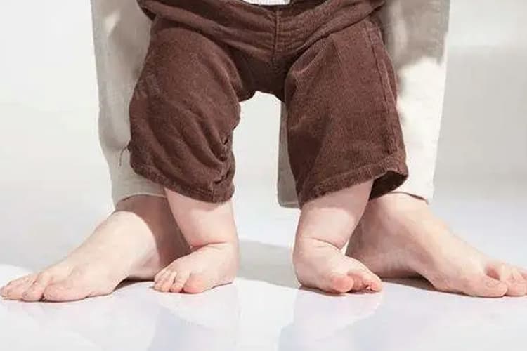 罗圈腿怎么矫正