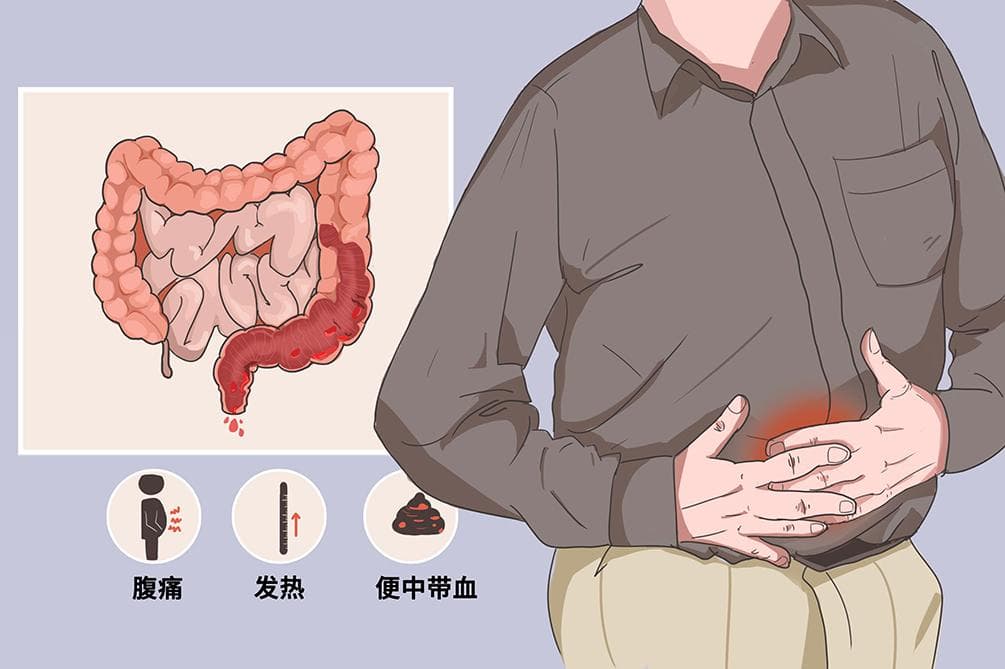 便血是什么原因