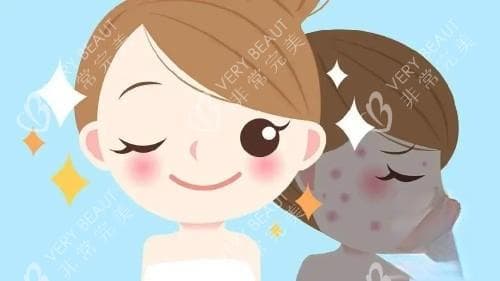 AOPT超光子嫩肤是什么？做一次有用吗？会保持多久呢？