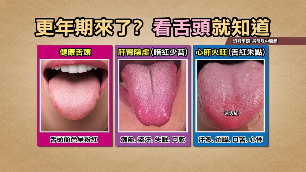 不只那英！更年期心烦、睡不好？3神穴解除燥热，1茶饮降虚火