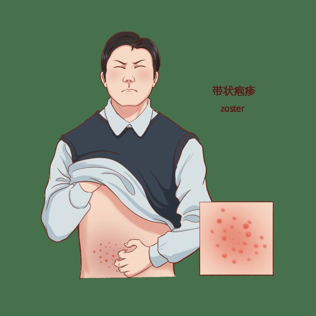 科普 | 带状疱疹的“切肤之痛”，早期识别很重要