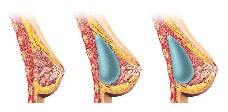 抗击乳腺癌25年，80岁的她分享抗癌历程