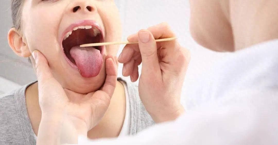 嗓子疼时喝什么有用？8种“饮品”上了推荐清单