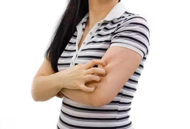 湿疹系列一：什么是湿疹？