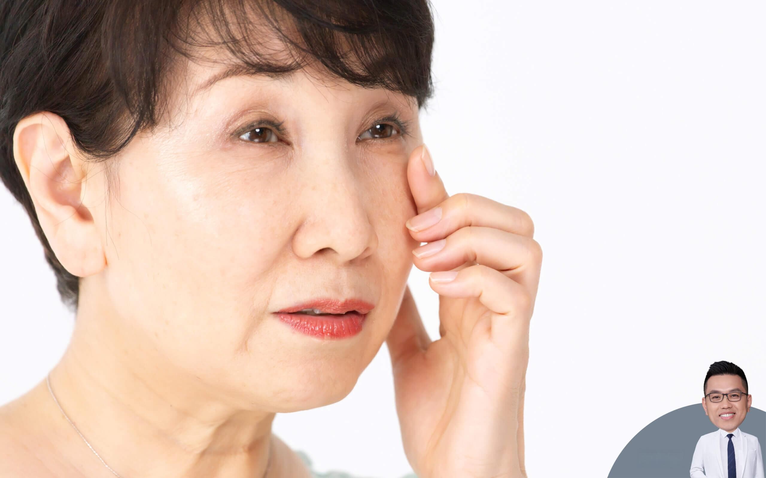 原来眼袋也有分“真”、“假”！分析真性眼袋与假性眼袋