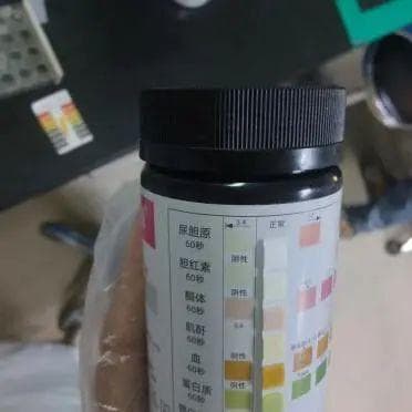 碱性尿致尿蛋白检测假阳性，检验科专家解析干扰原因