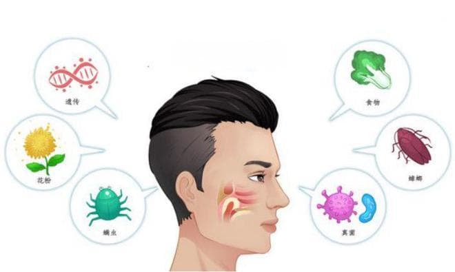 过敏性鼻炎VS非过敏性鼻炎：你真的分得清吗？