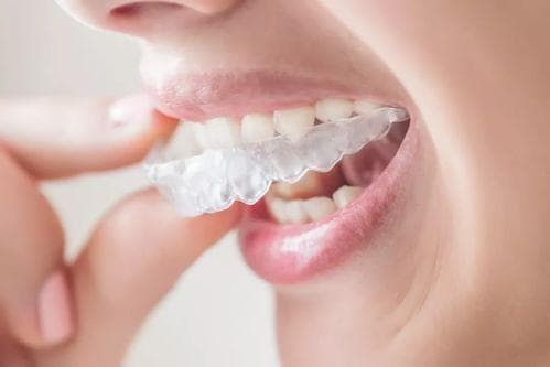 拔牙后多久可以开始牙齿矫正？拔牙矫正有什么需要注意的？