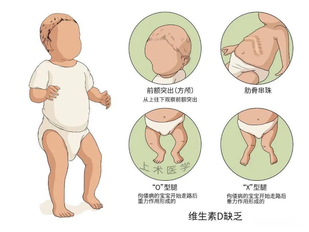 惊！维生素D除了补钙减肥，竟还有这些神奇功效