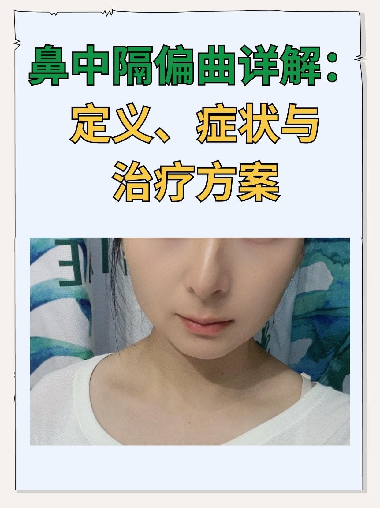 鼻中隔偏曲详解：定义、症状与治疗方案