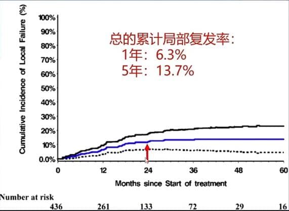 精准放疗在HCC中的应用和最新进展