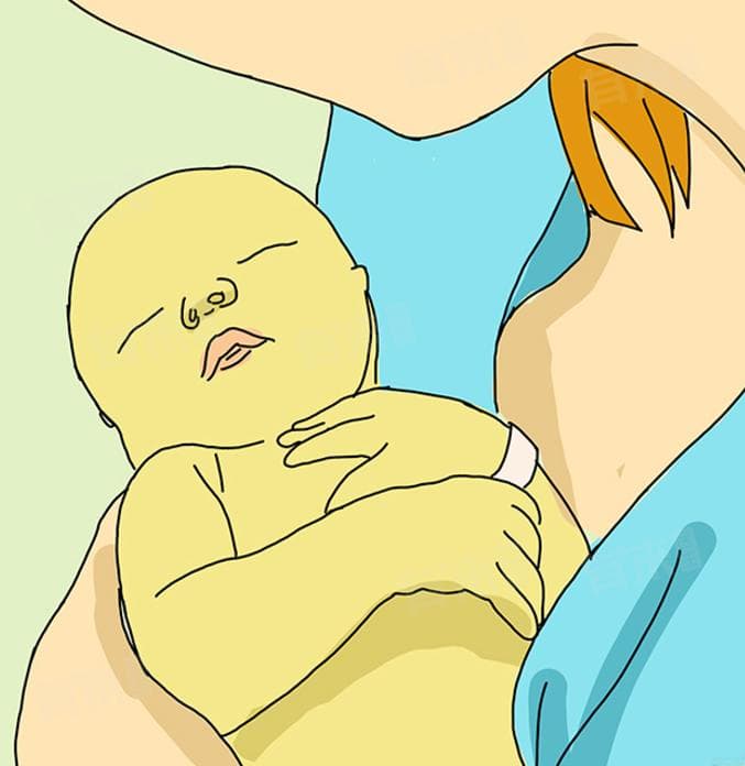 什么是母乳性黄疸