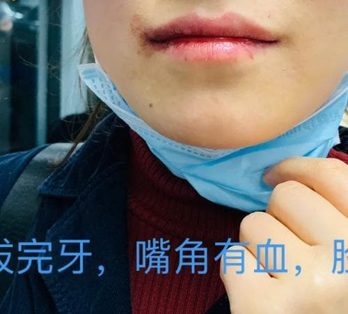 梦见牙被拔掉了是什么意思