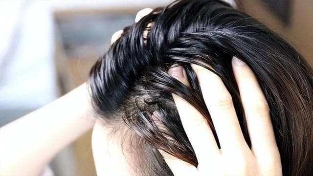 头发总是油腻腻的人，请对照一下，身上这5个坏习惯，请尽快改