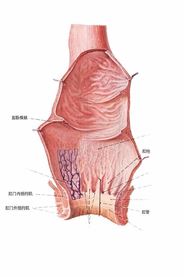 肠憩室可能伴随哪些疾病症状？