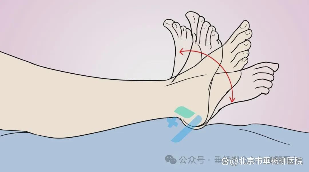 【杨柳科普】静脉曲张预防指南：5个动作+3件小事拯救你的腿