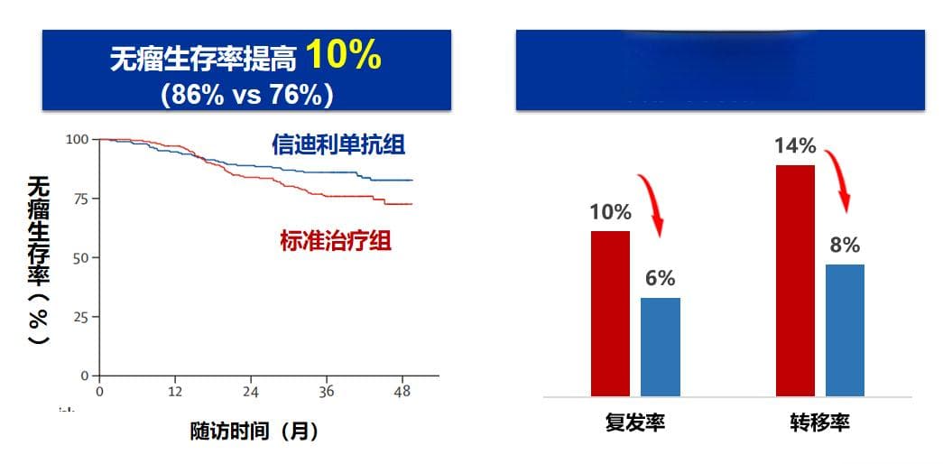 局部晚期鼻咽癌有了新疗法