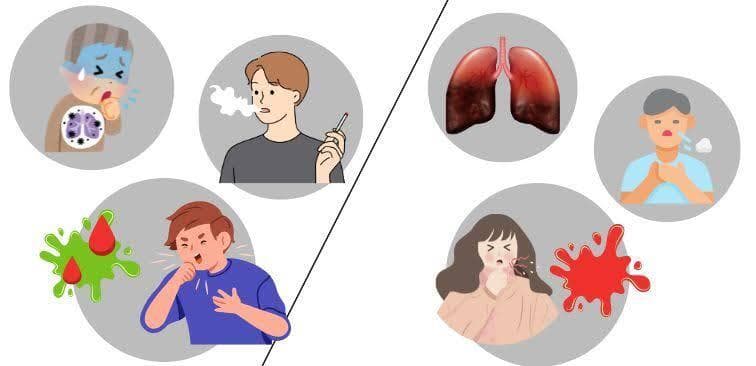 肺部手术后痰中带血怎么办？这些原因和处理方法请收好