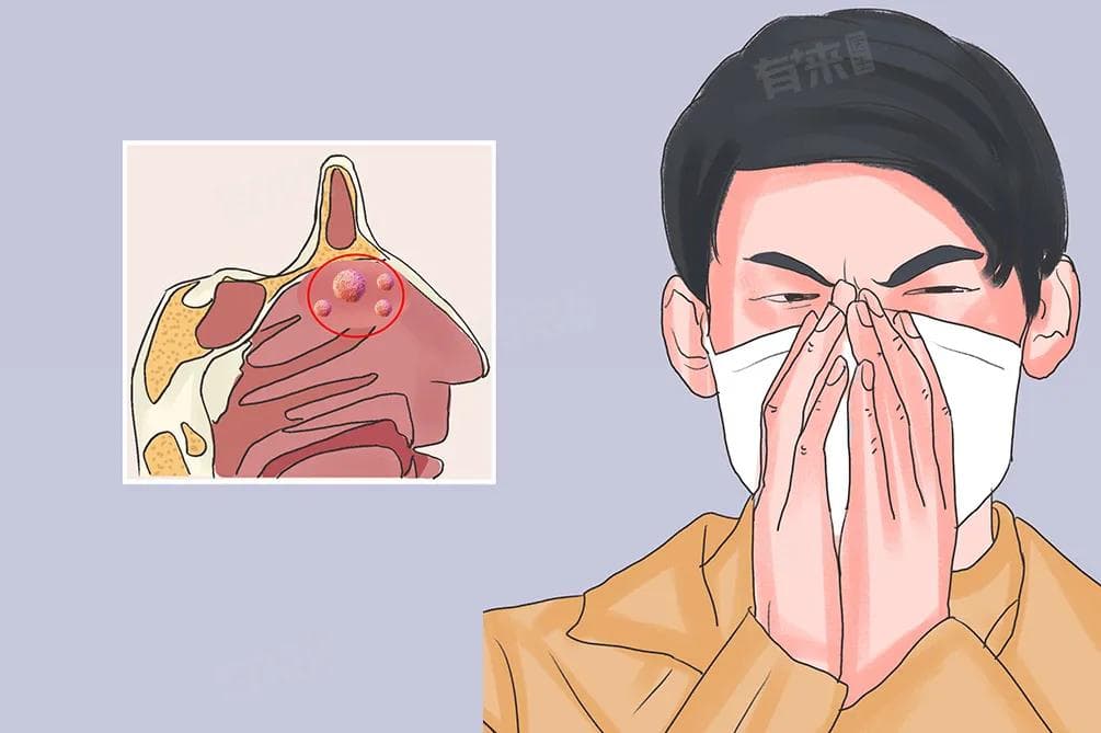 鼻血管瘤是什么病，能治愈吗