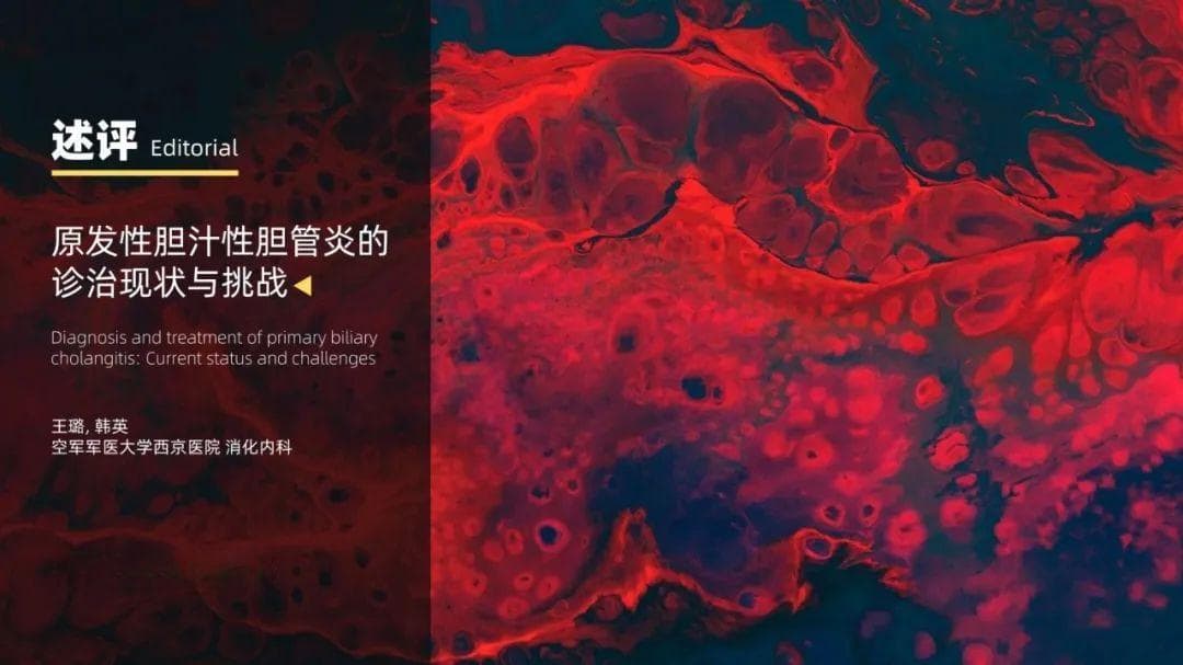 原发性胆汁性胆管炎的诊治现状与挑战