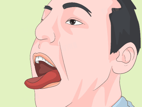 舌尖麻木是什么病的前兆