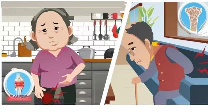 【微科普】浅谈老年人常见关节病—骨关节炎