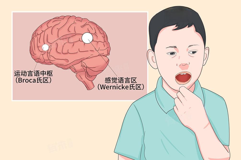 语言障碍是什么原因引起的