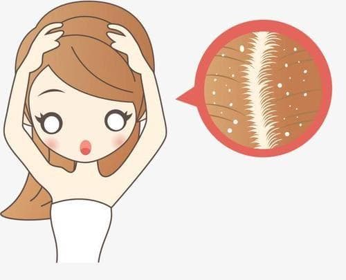 为什么有些人每天洗头发也洗不干净头皮屑？