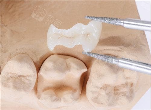 如何固定松动的牙齿？这些常用方法值得了解