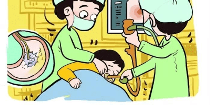 一步到“胃”，了解胃镜检查那些事儿