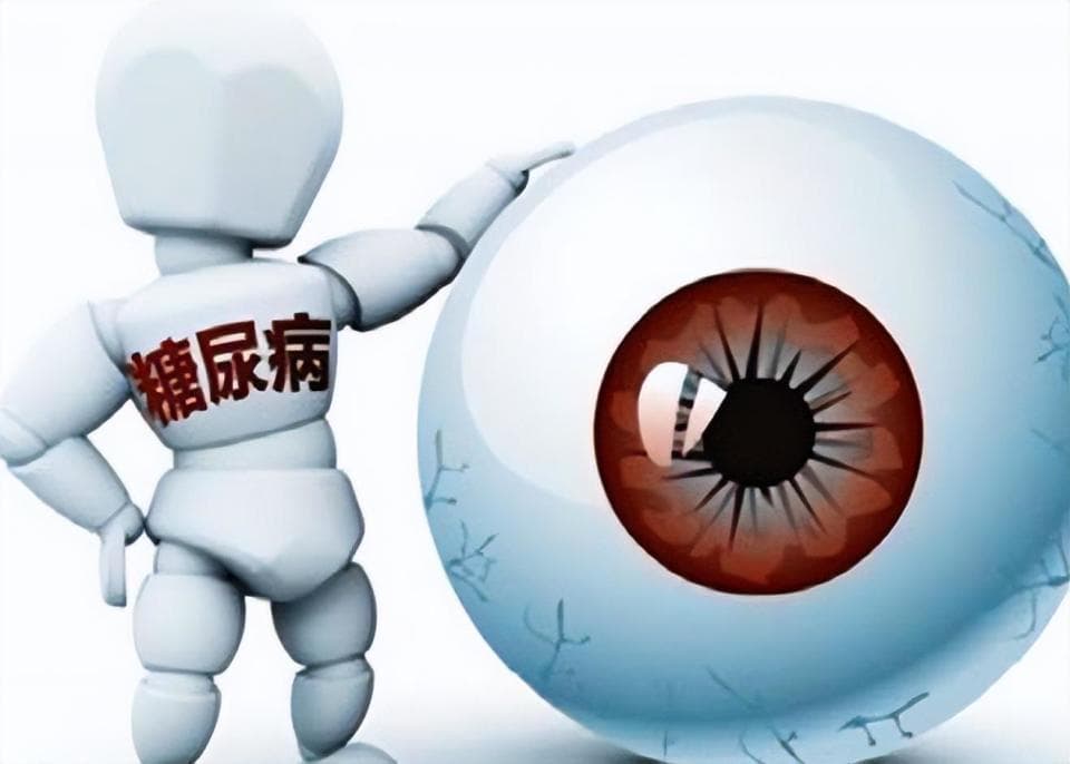糖尿病日常做好管理，眼睛出现这些症状，小心糖尿病视网膜病变