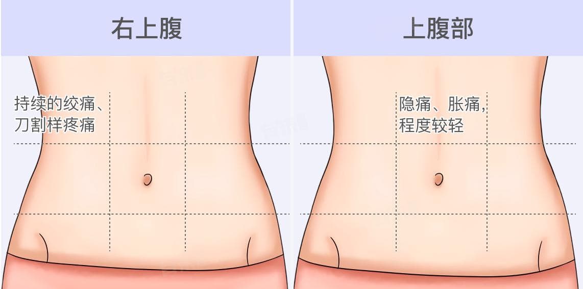 胆囊结石的症状是哪里疼