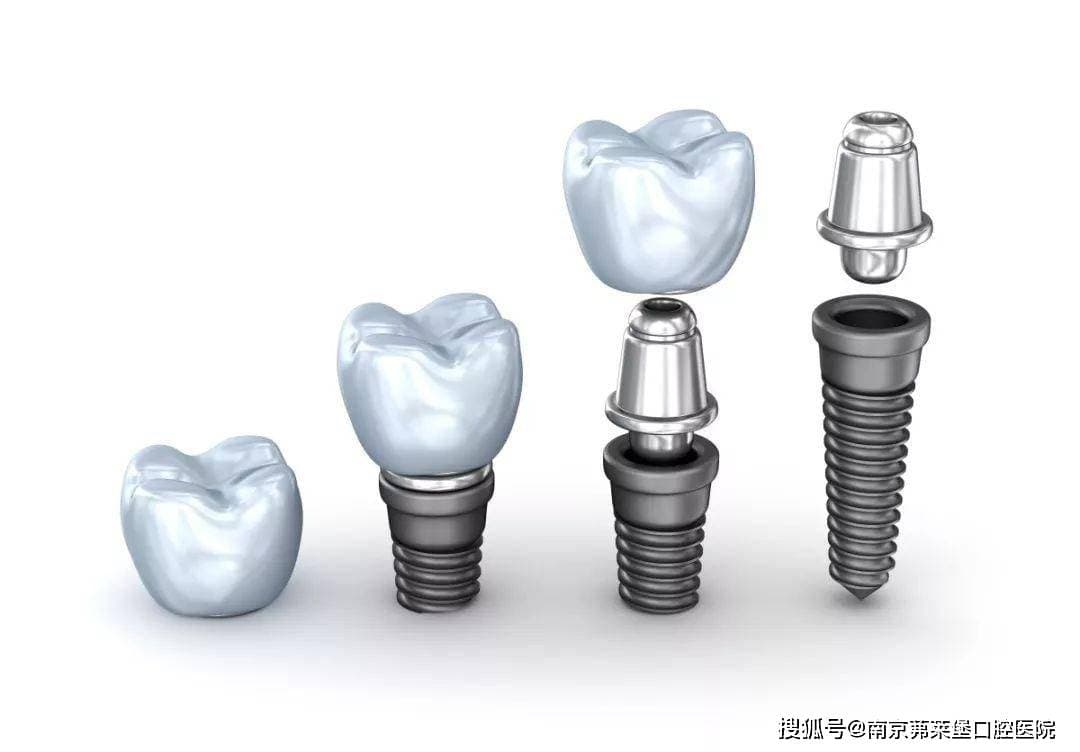 茀莱堡口腔医院：装假牙能用医保吗能报销吗