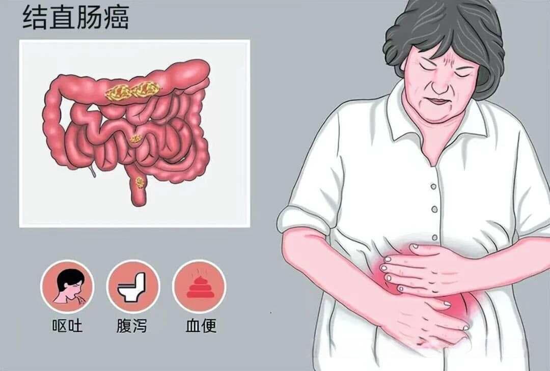 肠道菌群与脾虚证竟然紧密关联：现代医学与传统中医智慧的交汇点