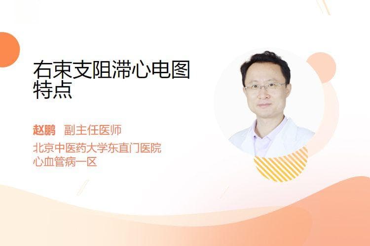 右束支阻滞心电图特点
