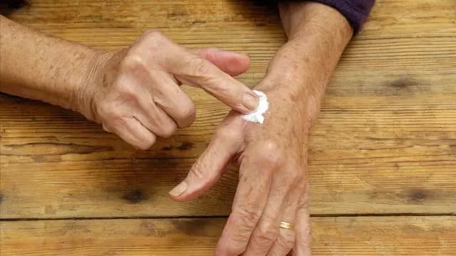为何有人满脸“老人斑”？红霉素软膏能去除老人斑？不妨了解一下
