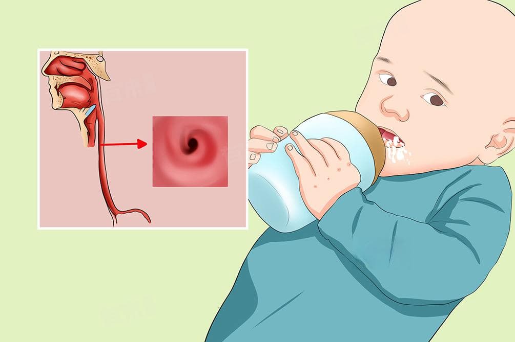 食管狭窄治疗最新方法及术后养护指南
