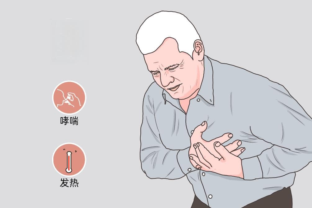 嗜碱性粒细胞增多症：病因、症状与治疗全解析
