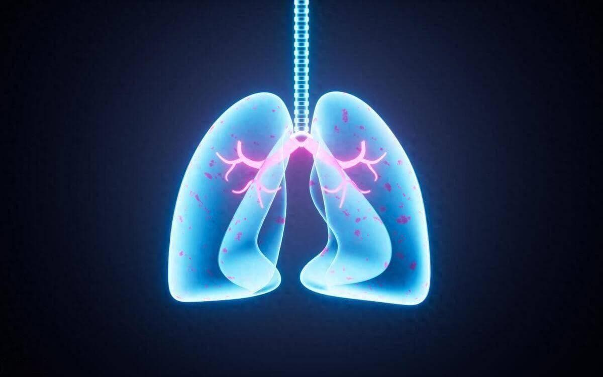 肺癌早期不痛不痒？医生告诫：若不想受罪，出现这些症状及时筛查