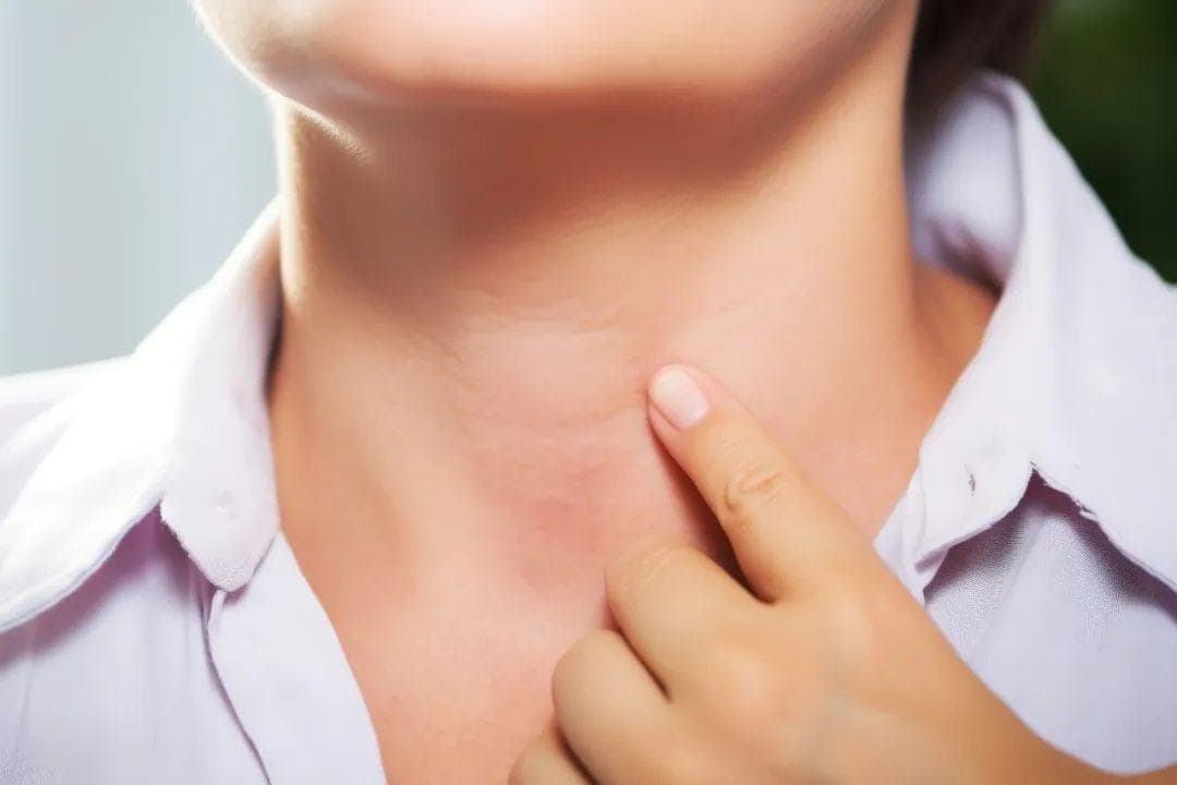 甲状腺疾病你了解多少？
