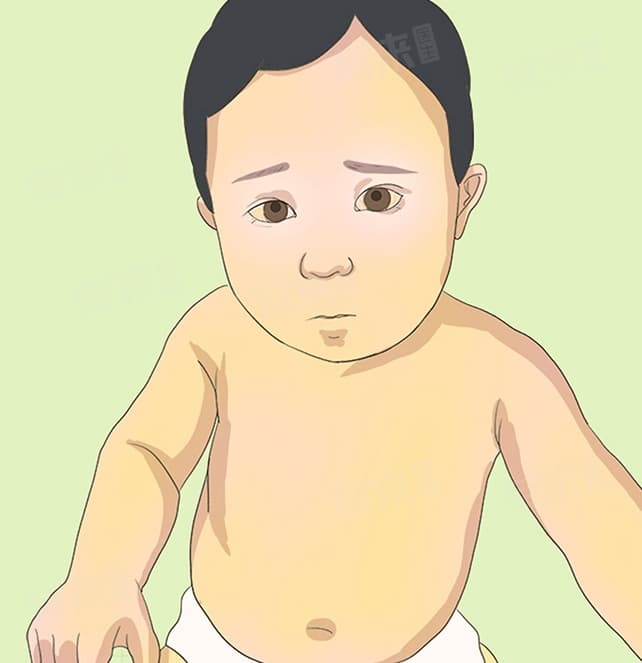 新生儿黄疸的治疗方法及检查项目详解