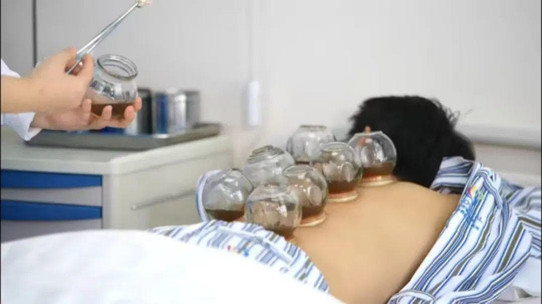 类风湿患者关心的中医治疗有哪些