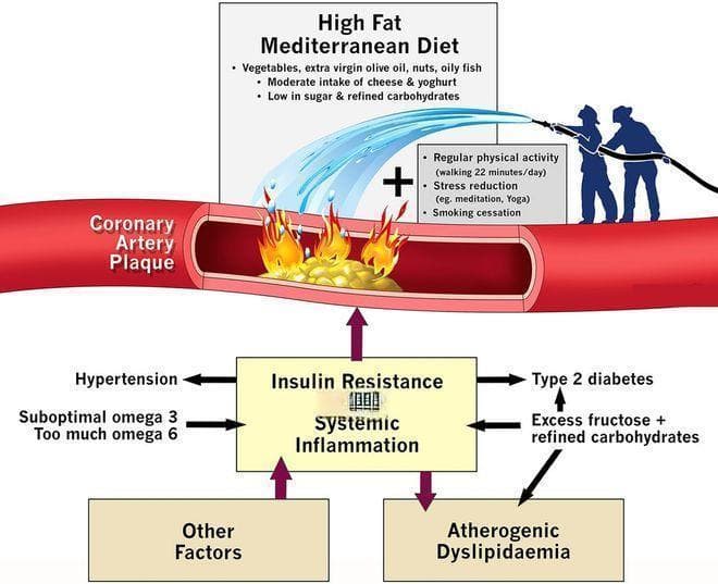 最新研究：阿托伐他汀降脂效果更强，但匹伐他汀更适合糖尿病患者