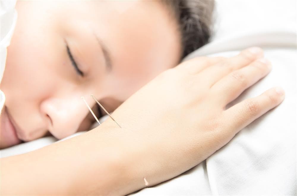睡眠呼吸暂停综合征：针灸治疗效果如何？