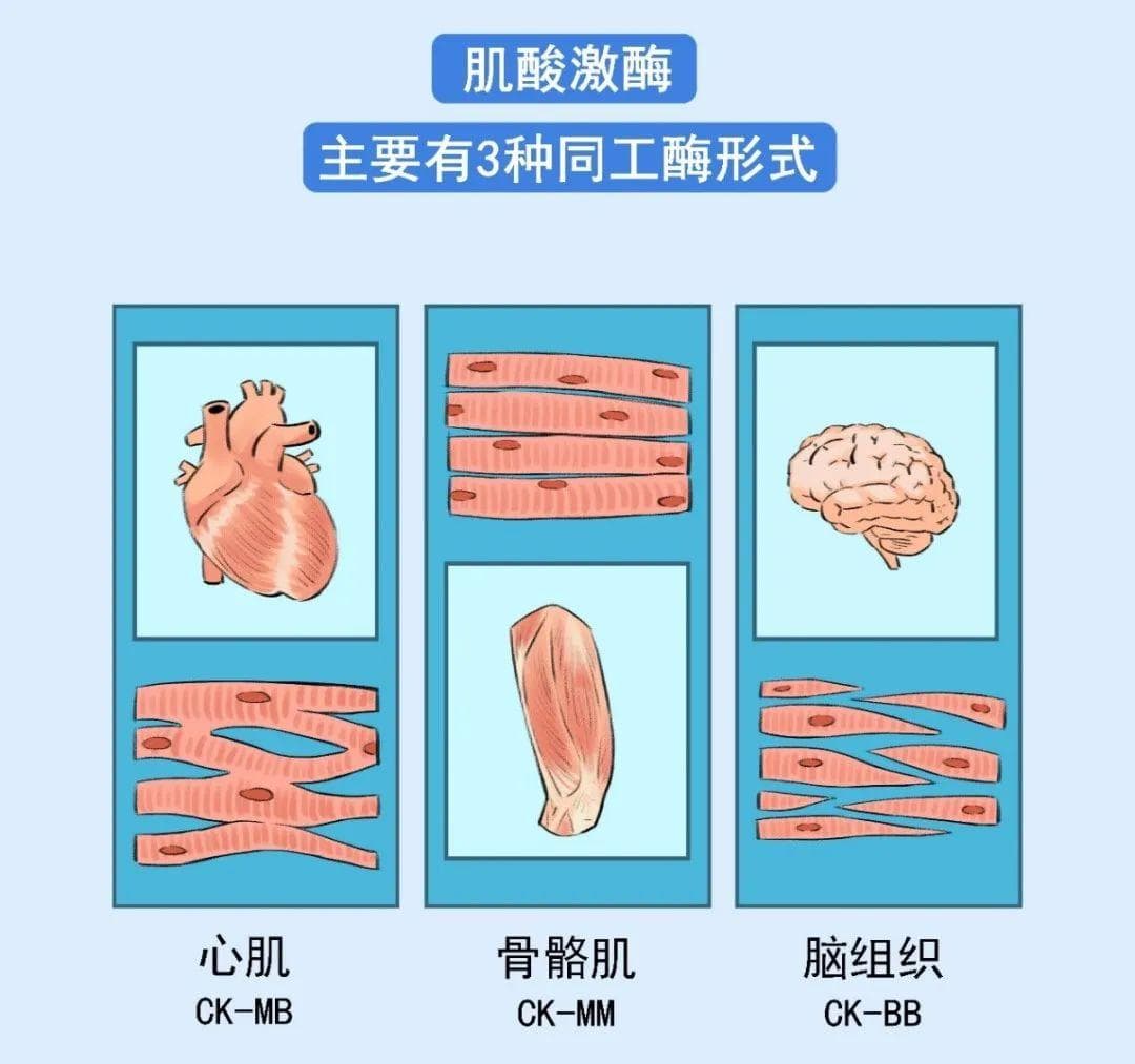 健康科普丨肌酸激酶增高，是心脏受损伤了吗？