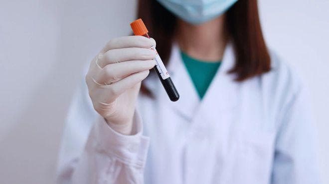 多久查一次血脂最合适？身体若出现这些症状，一定要尽早检查