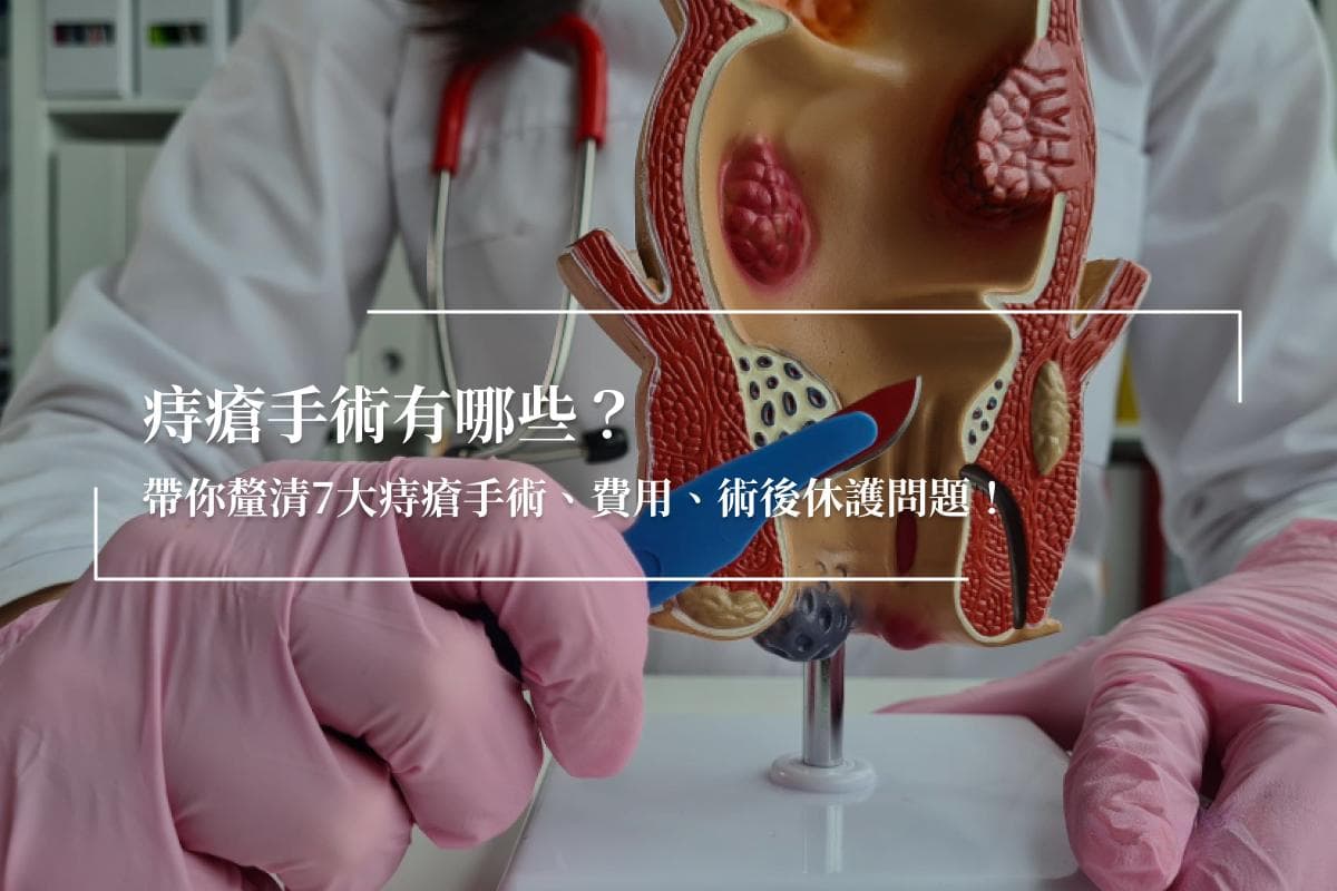 痔疮手术有哪些？带你厘清7大痔疮手术、费用、术后休护问题！
