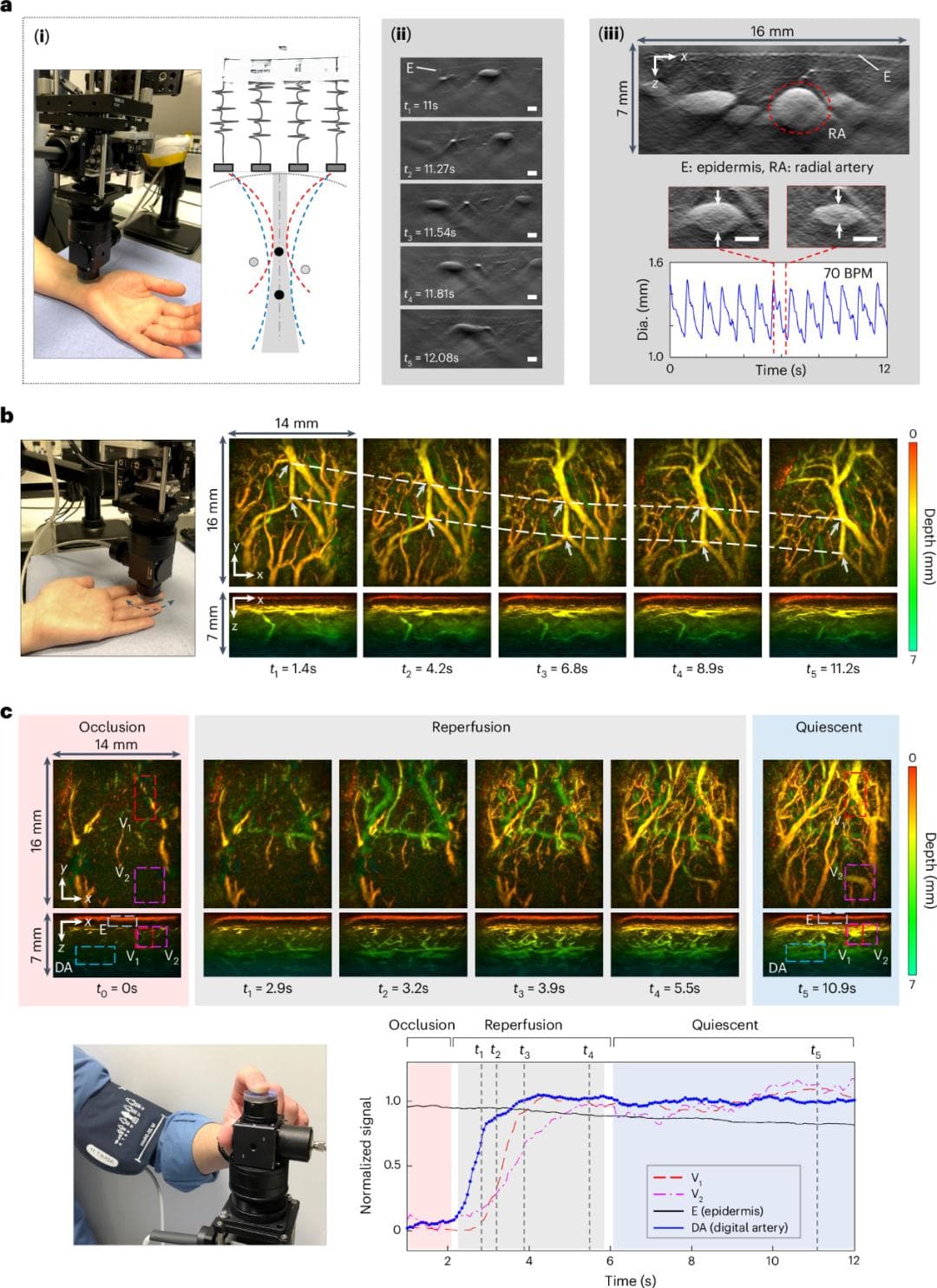 临床血管成像迎来新突破：Nature子刊发布新型光声扫描仪